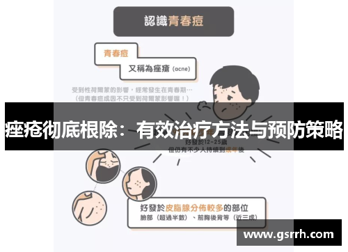 痤疮彻底根除：有效治疗方法与预防策略